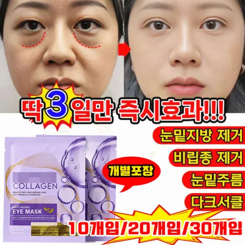 [개별포장] 50개/30개/20개 콜라겐 눈밑지방 제거 패치 아이백 다크서클 눈밑꺼짐 눈밑주름 제거 팔자 주름개선 패치 아이케어
