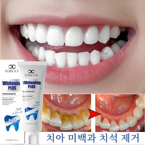 미백 치약 Whitening Toothpaste 프로바이오틱스 치약 치태 치약 치태 제거 프로바이오틱스 미백 치약 프로바이오틱스 치태 치약 구취 제거, 100g, 2개